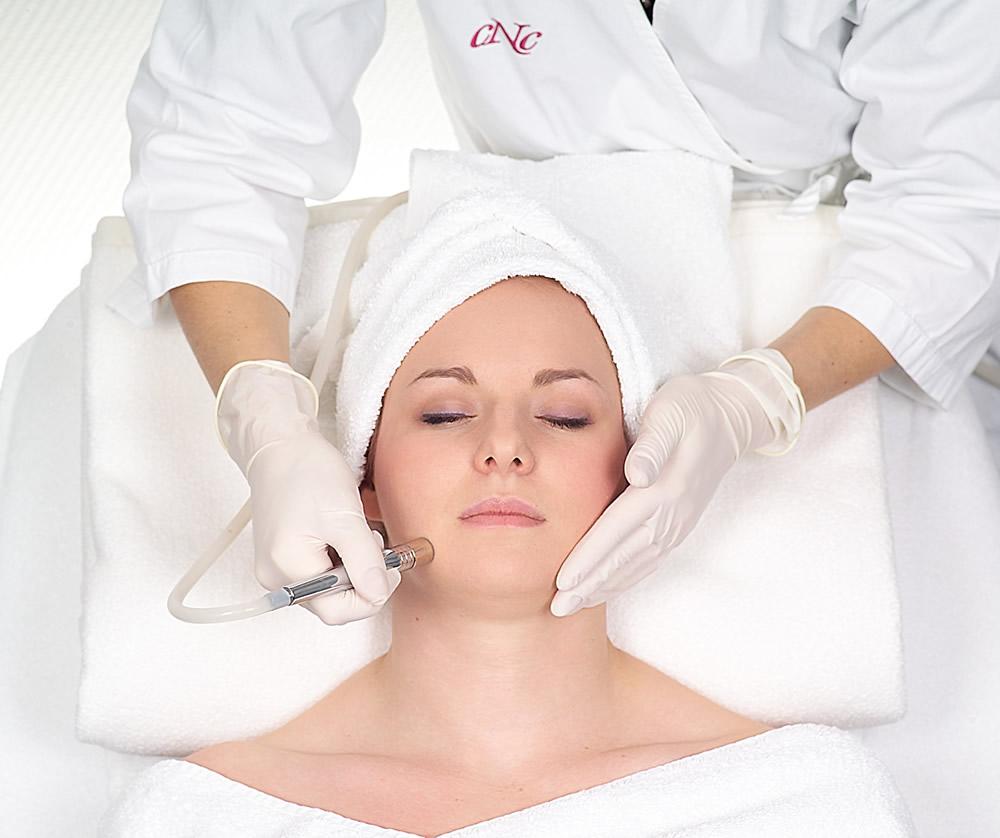 Diamant Microdermabrasion Behandlungen